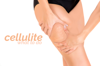 Cellulite - what to do?